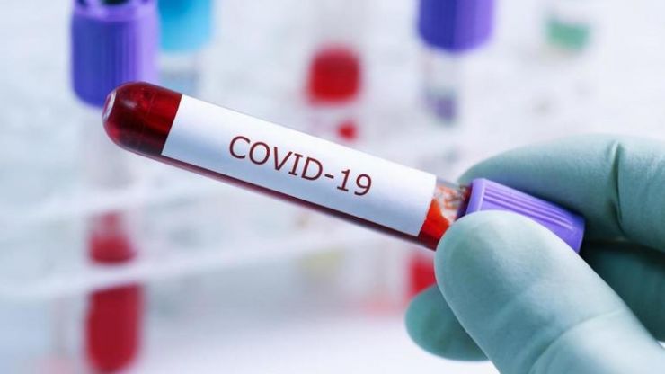 COVID-19 | Peste 9.700 de teste efectuate în județul Satu Mare